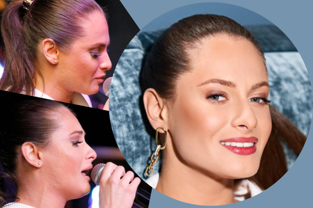 Artista a scăpat de acnee și are un ten impecabil