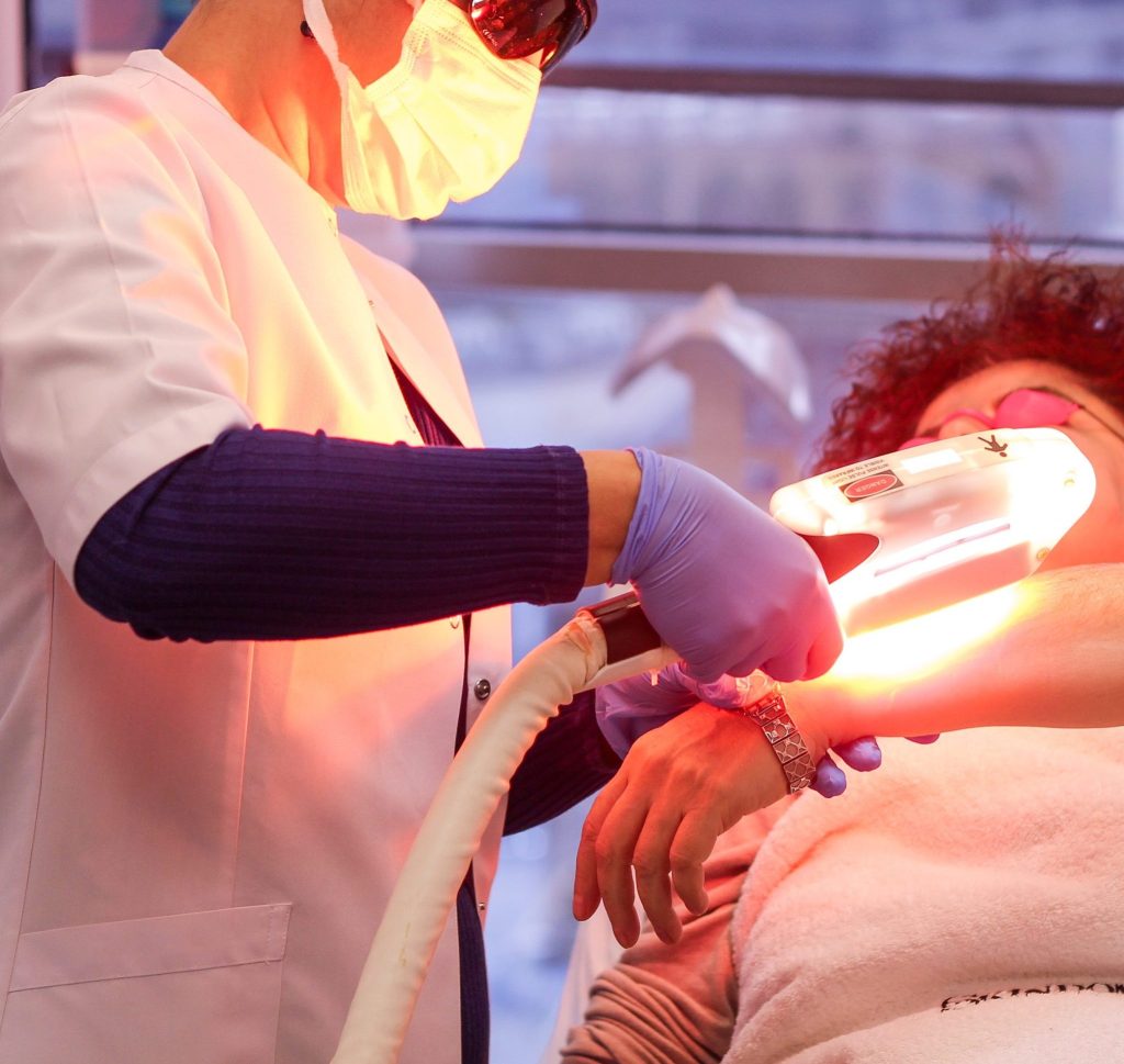 Ce beneficii are epilarea cu laser