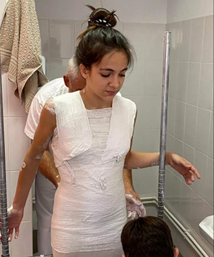 Fiica Roxanei Ciuhulescu poartă un corset pentru îndreptarea coloanei vertebrale