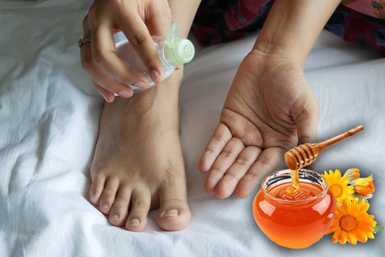 Cum scapi de călcâiele uscate și crăpate cu ingrediente naturale. 5 soluții care au rezultate rapide