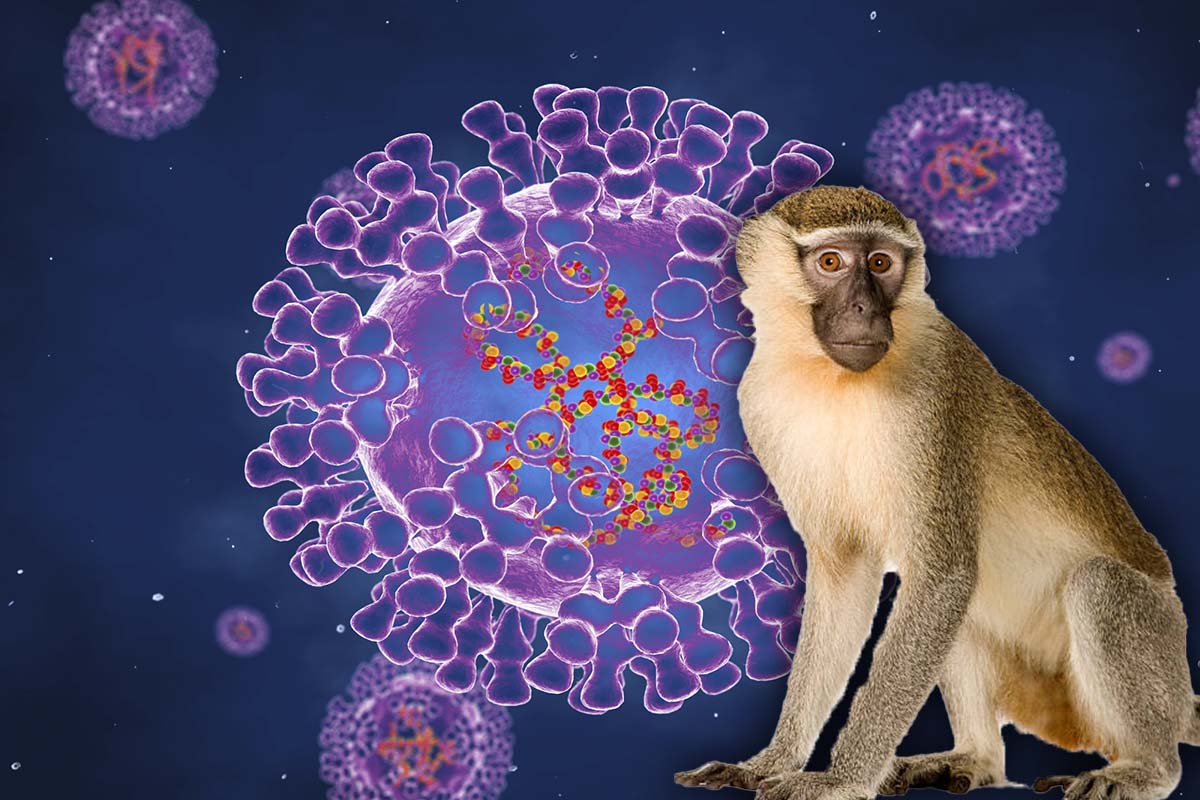 Revin restrictiile de calatorie din cauza variolei maimutei