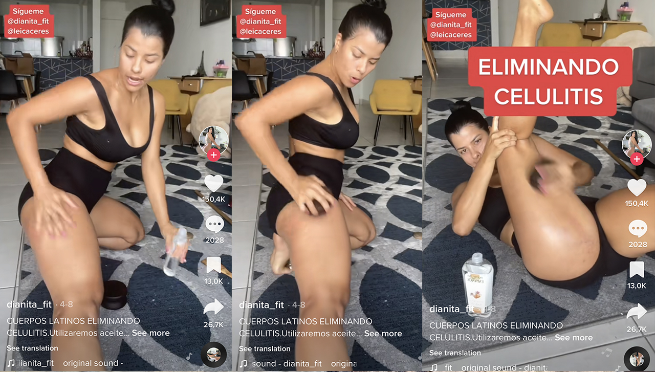 Masajul care te scapă de celulită