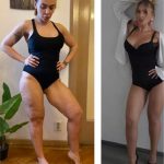 Oana Radu s-a luptat cu celulita