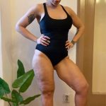 Oana Radu s-a luptat cu celulita