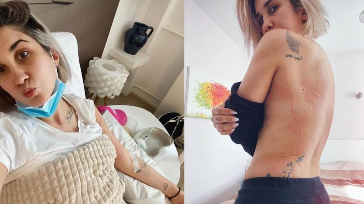 Adda, diagnosticată cu boala Lyme