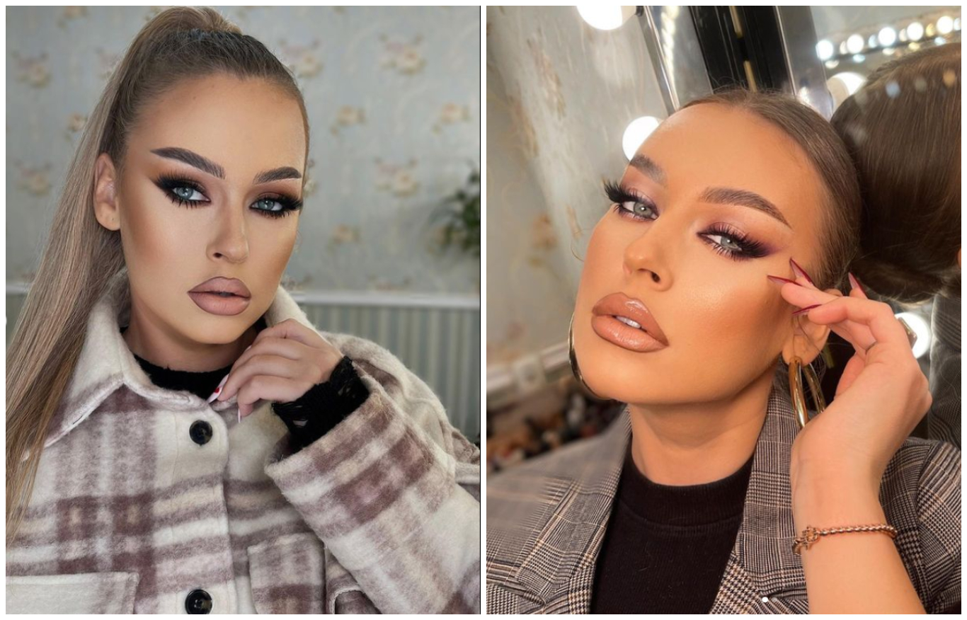 Misha de nerecunoscut! Ce a pățit la față fosta soție a lui Connect-R.