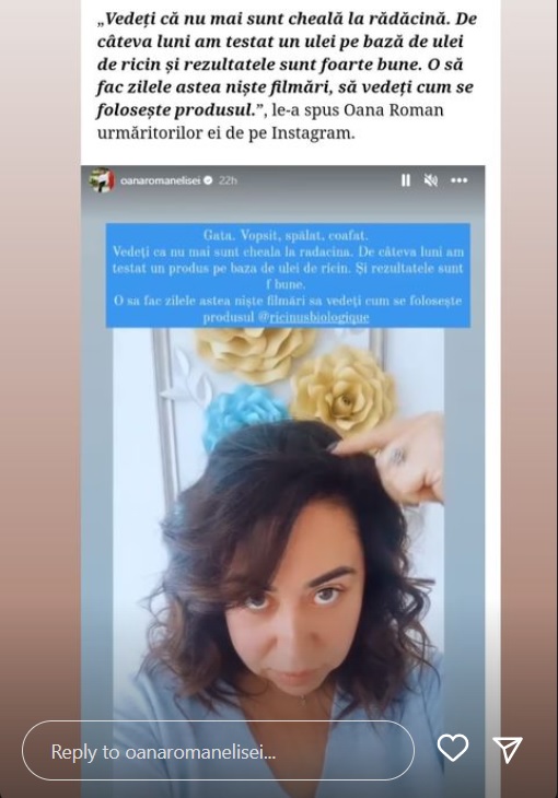 Tratamentul folosit de Oana Roman impotriva caderii parului