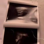 Ecografia cu care Florin Ristei și-a păcălit fanii că logadnica lui este însărcinată