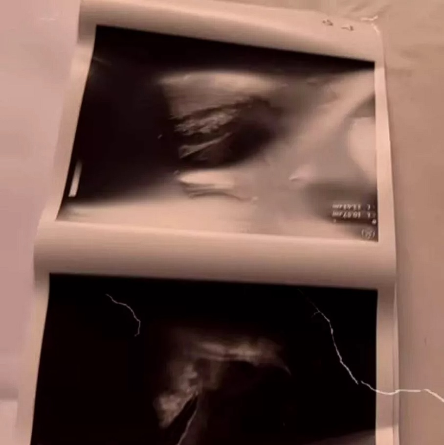 Ecografia cu care Florin Ristei și-a păcălit fanii că logadnica lui este însărcinată