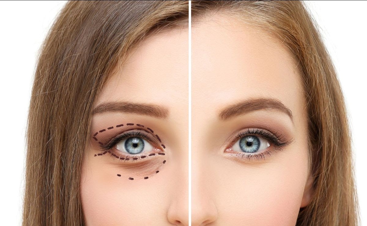 Dr. Iancu Morad ne explică cum putem corecta asimetriile faciale