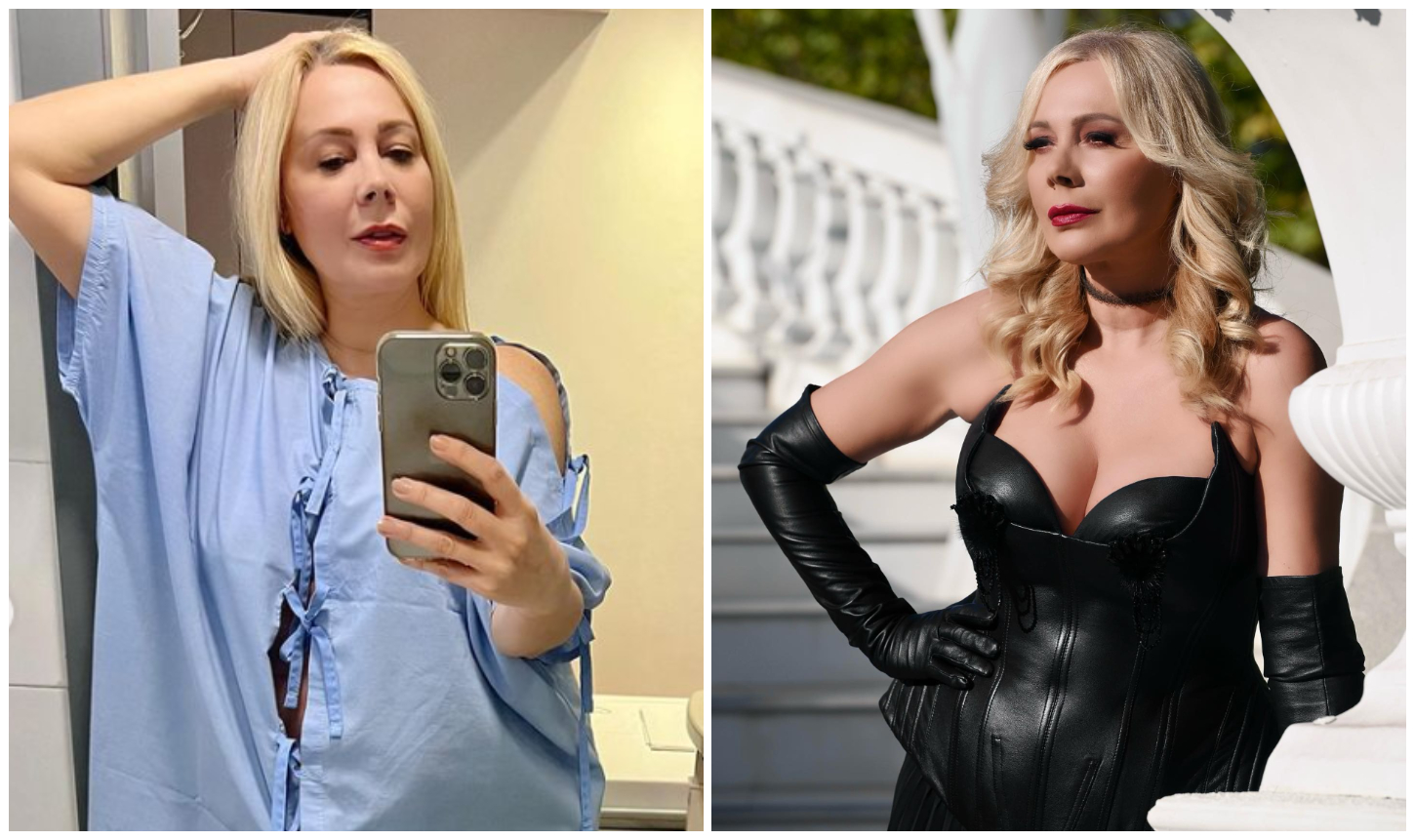 Dana Săvuică a ales sa isi facă reducție mamara