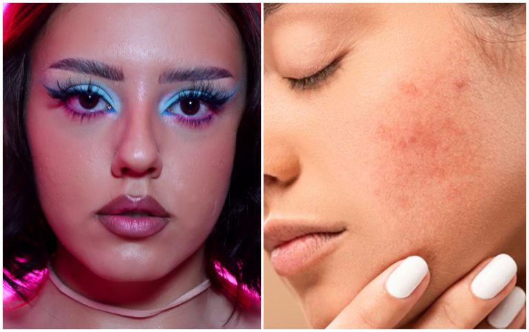 Machiajul tenului cu tendință acneică. Claudia Preduca, make-up artist: „Roșeața se ascunde cu un corector verde” SPECIAL