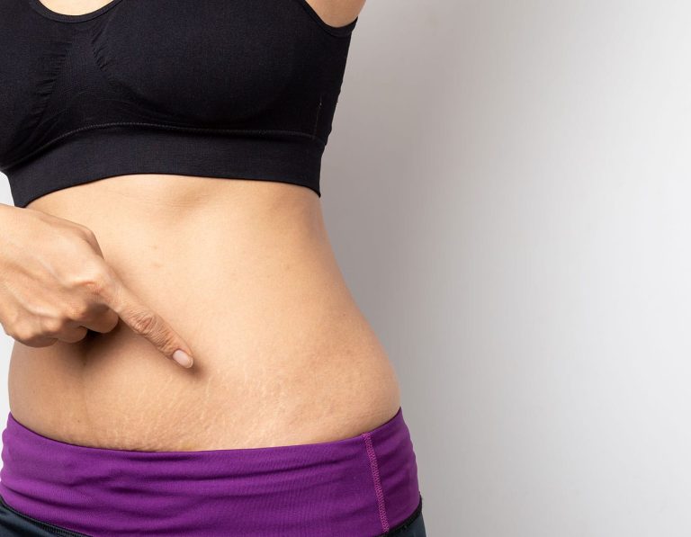 În cât timp se retrage burta după naștere. Ce e important să știe orice femeie care trece prin această etapă