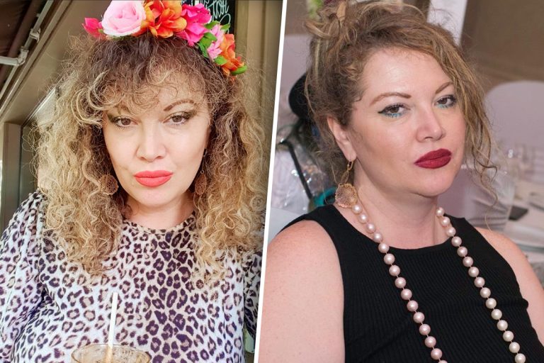 Diagnosticul crunt primit de Oana Lis din partea medicului: „Foarte, foarte reactivă pielea mea”. Vedeta dezvăluie cu ce mari probleme s-a confruntat VIDEO EXCLUSIV