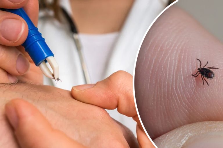 Trucul genial prin care poți scăpa de căpușe. Cum trebuie să procedezi, de fapt. Pașii esențiali