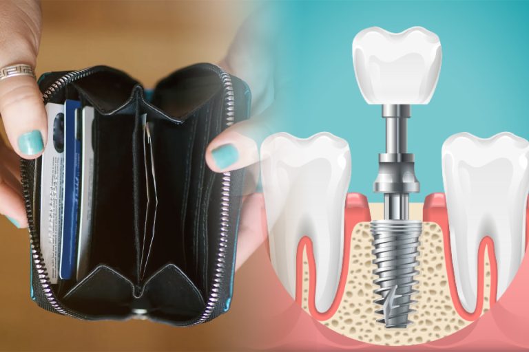 Cât costă un implant dentar în 2023. Prețurile sunt uriașe, suma pe care trebuie să o scoți din buzunar