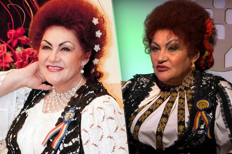 Câte operații estetice are Elena Merișoreanu, de fapt. Puține femei au curajul ei