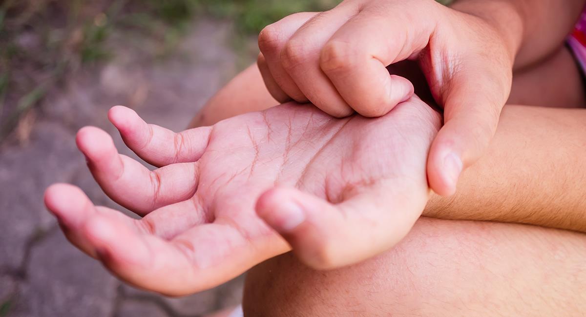 superstiții legate de mâncărimea mâinilor