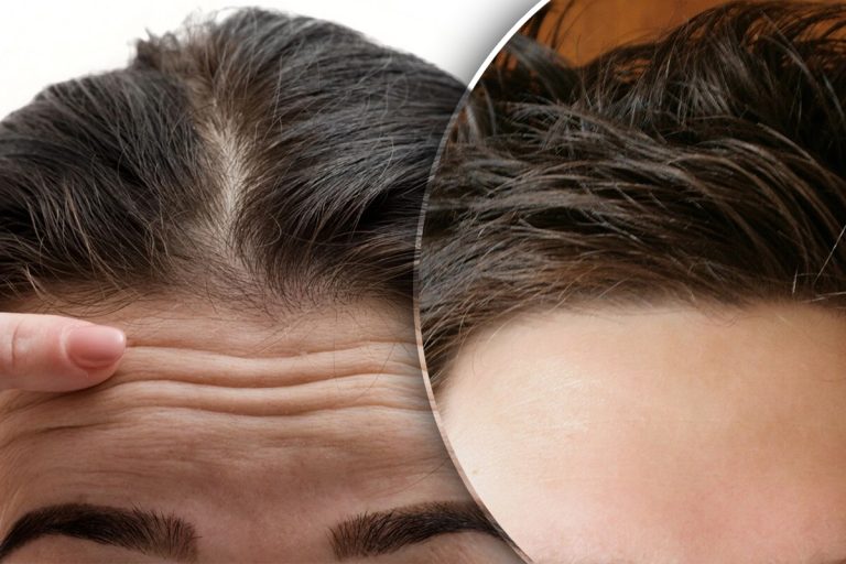 Ce dezvăluie forma frunții despre personalitatea ta. Detaliul care arată un aspect important despre viața ta