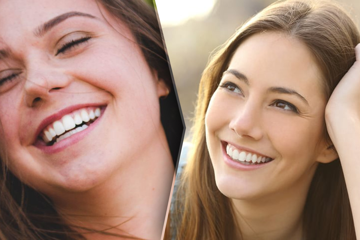 Ce spune forma dintilor despre tine