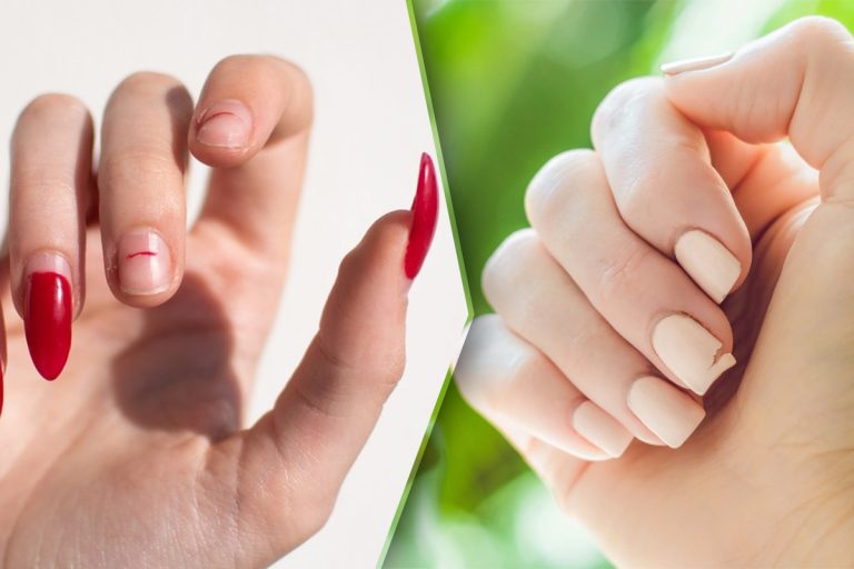 Ce trebuie să faci dacă ți-ai rupt unghiile. 4 trucuri practice și eficiente pentru a-ți repara manichiura