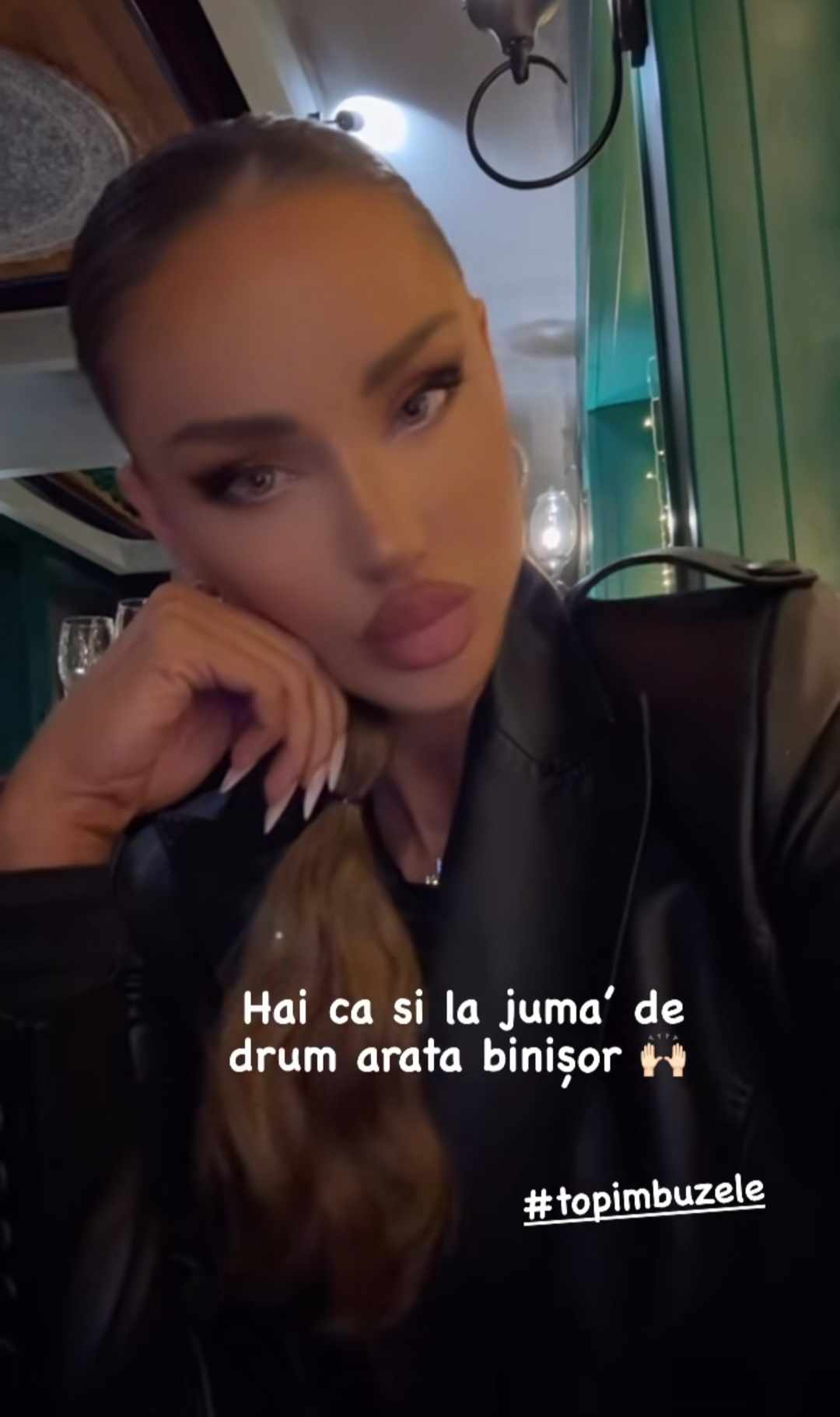 Cum arata Bianca Dragușanu, dupa ce si-a topit acidul hialuronic din buze 1