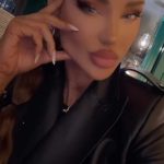 Cum arata Bianca Dragușanu, dupa ce si-a topit acidul hialuronic din buze 3