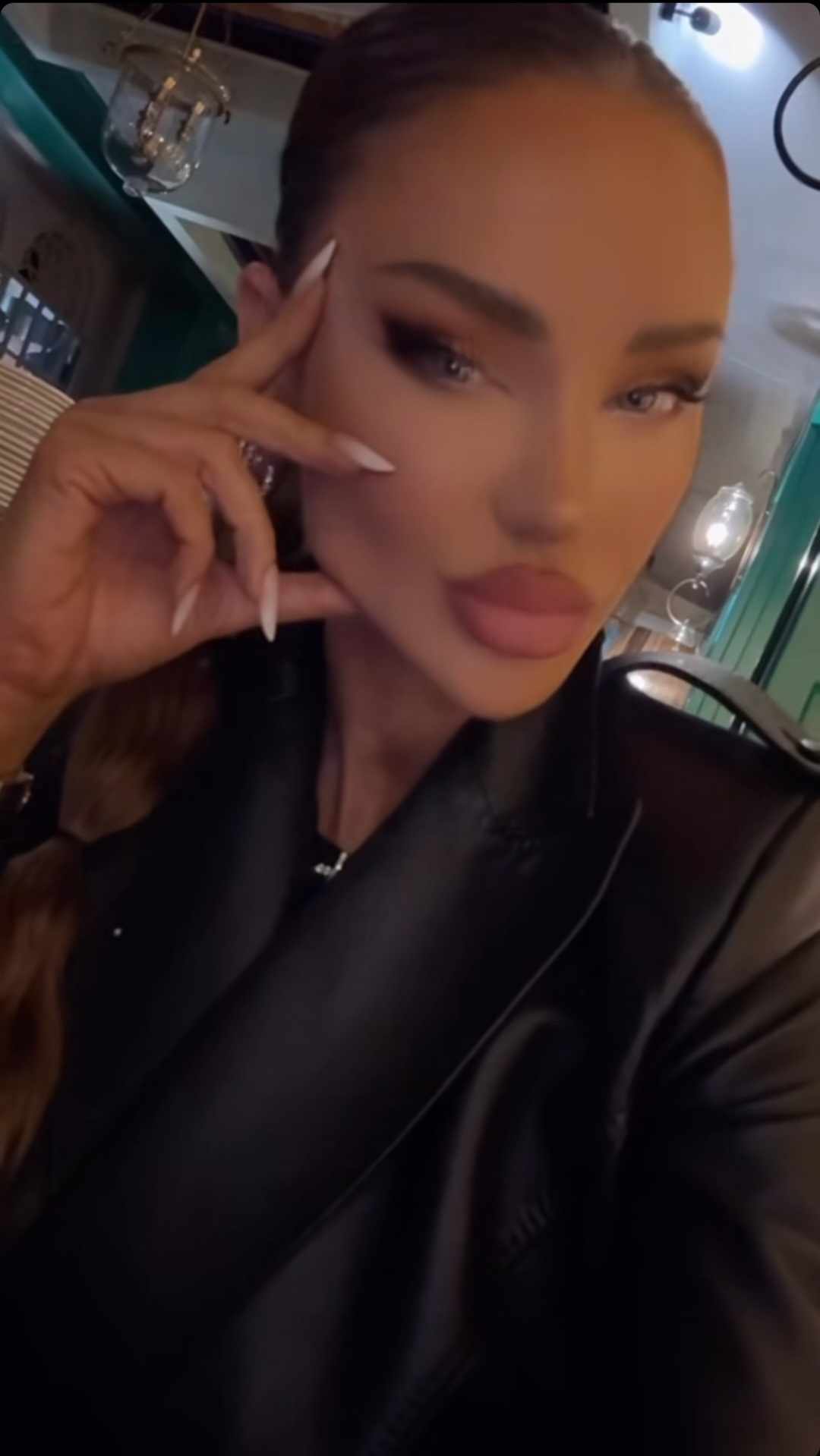 Cum arata Bianca Dragușanu, dupa ce si-a topit acidul hialuronic din buze 3