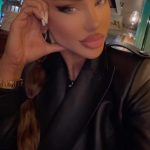 Cum arata Bianca Dragușanu, dupa ce si-a topit acidul hialuronic din buze 4