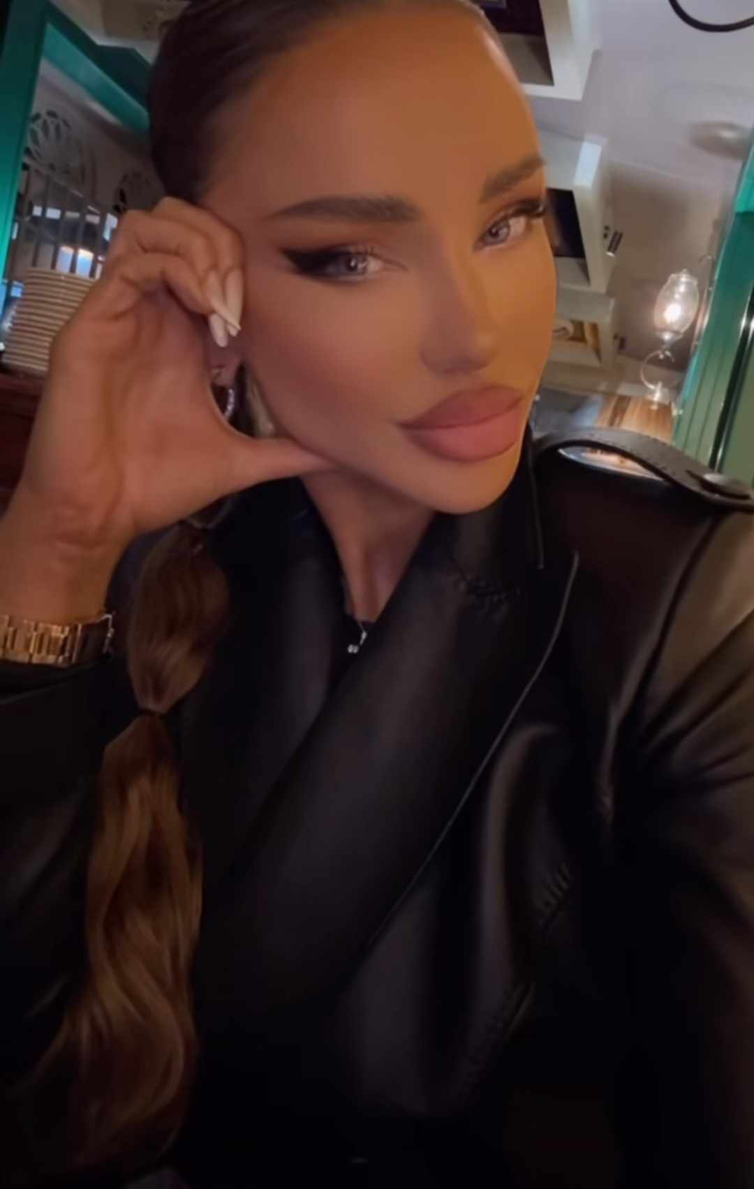 Cum arata Bianca Dragușanu, dupa ce si-a topit acidul hialuronic din buze 4