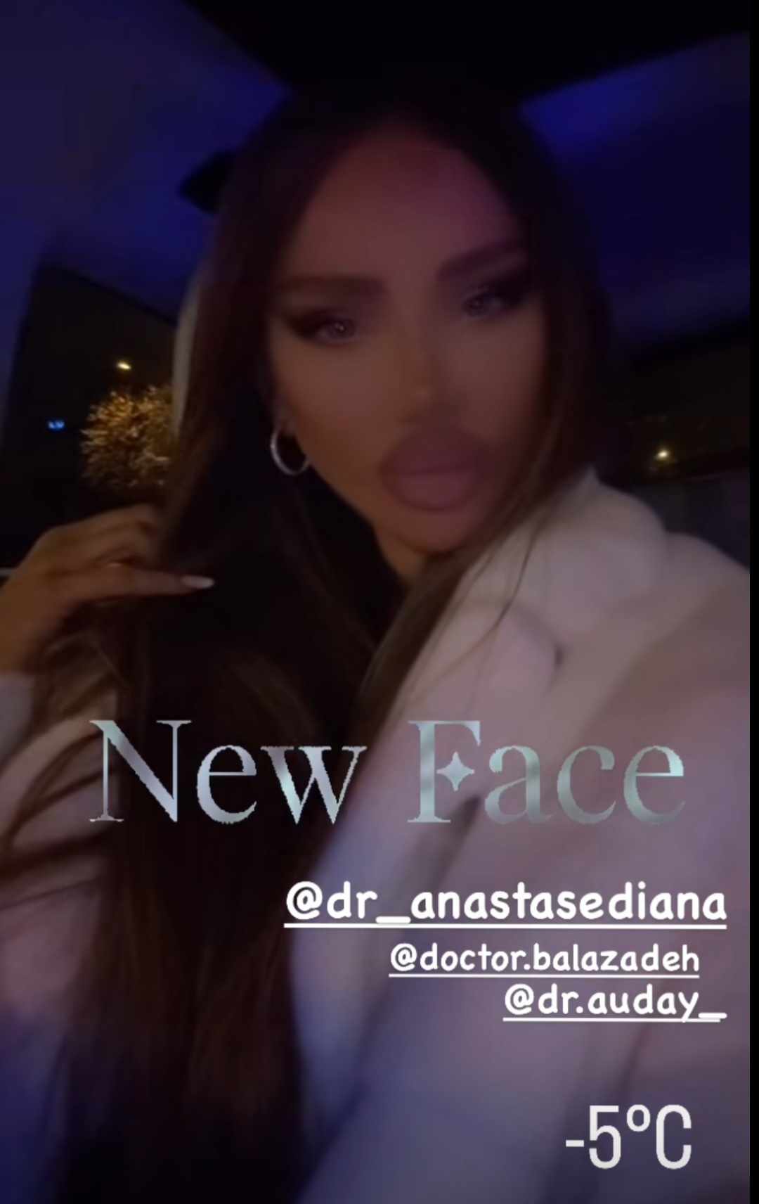 Cum arata Bianca Dragusanu, la 2 saptamani de la interventia de lifting 1