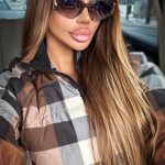 Cum arata Bianca Dragusanu, la 2 saptamani de la interventia de lifting 2