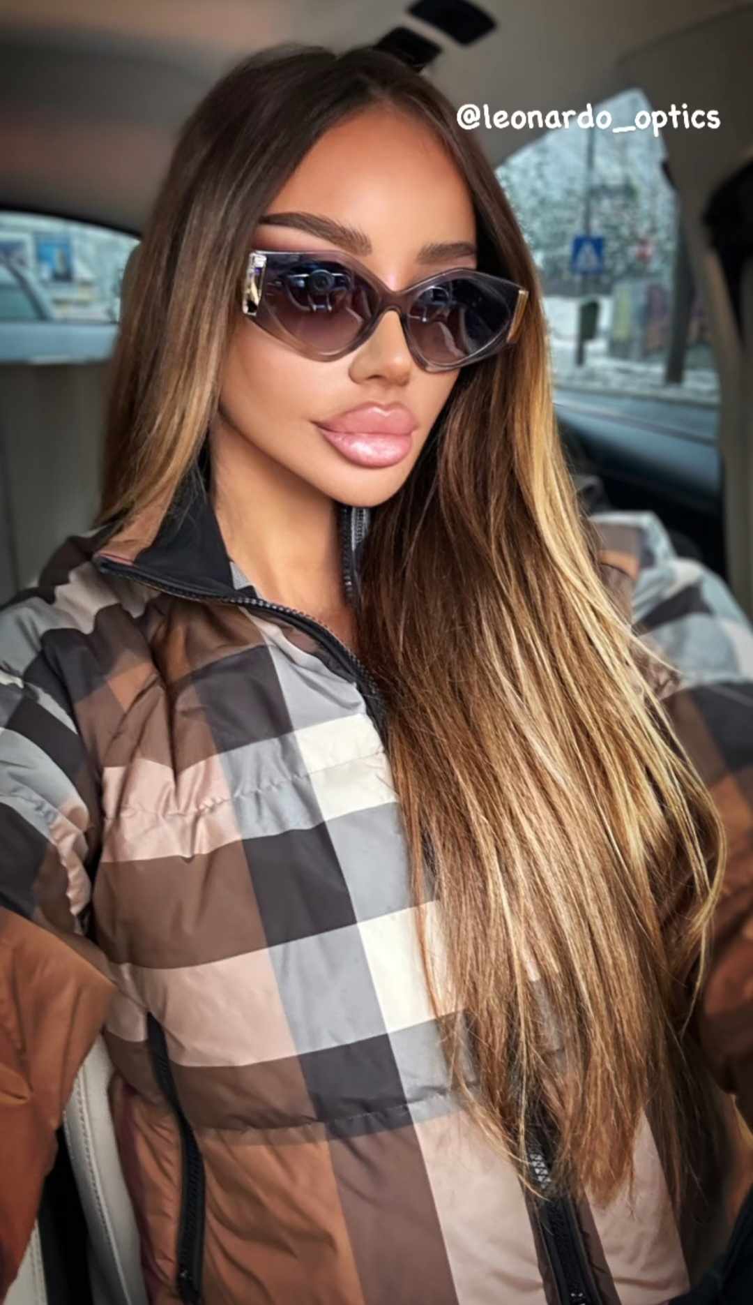 Cum arata Bianca Dragusanu, la 2 saptamani de la interventia de lifting 2