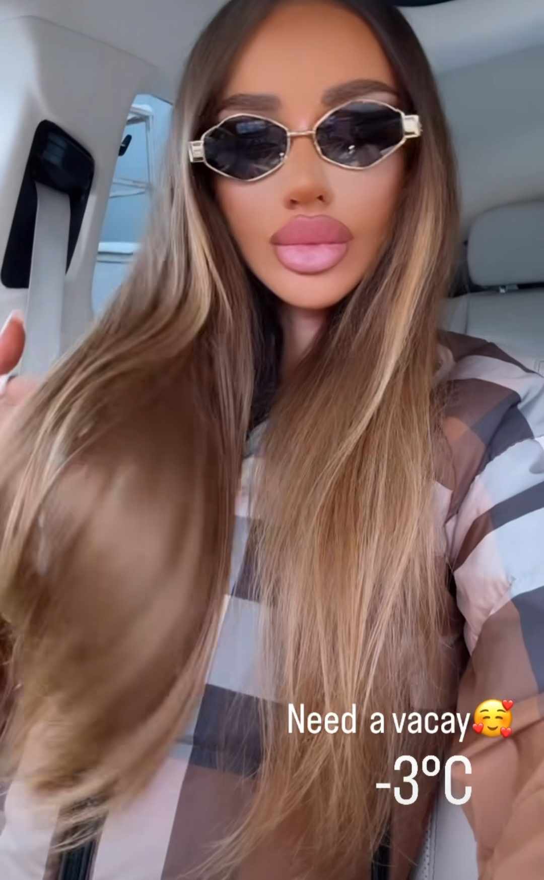 Cum arata Bianca Dragusanu, la 2 saptamani de la interventia de lifting 3