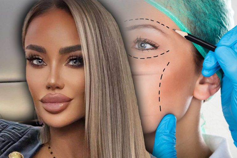 Cum se afișează Bianca Drăgușanu, după ce și-a făcut o nouă intervenție: ”Am ales să port cagulă. Sunt foarte inflamată și foarte vânătă” FOTO