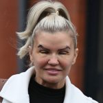 Merseyside, UNITED KINGDOM  - *PREMIUM-EXCLUSIVE*  - *MUST CALL FOR PRICING* Barely able to open her eyes, former Atomic Kitten star Kerry Katona reveals the bold results of her recent Eye Lift! 

Kerry shows off her sore scars as the star grapples with the aftermath of her cosmetic decision while leaving the Pall Mall Medical Centre in Merseyside.

*Pictures Containing Children Please Pixelate Face Prior To Publication*,Image: 839697926, License: Rights-managed, Restrictions: , Model Release: no, Pictured: Kerry Katona, Credit line: FARRELL / BACKGRID / Backgrid UK / Profimedia