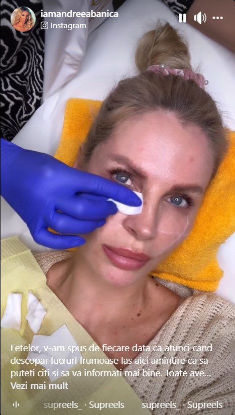 Ce interventie si-a facut Andreea Banică la fata 1