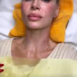 Ce interventie si-a facut Andreea Banică la fata 2