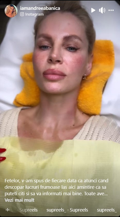 Ce interventie si-a facut Andreea Banică la fata 2