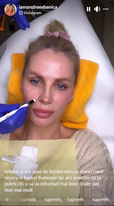 Ce interventie si-a facut Andreea Banică la fata 4