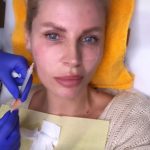 Ce interventie si-a facut Andreea Banică la fata 5