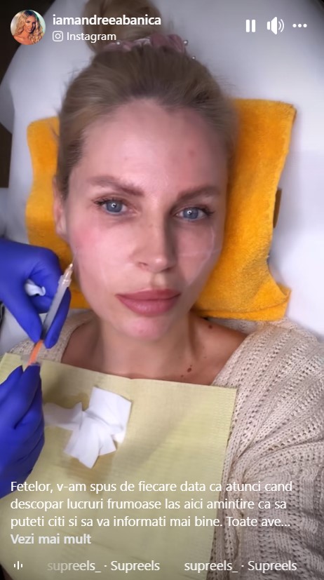 Ce interventie si-a facut Andreea Banică la fata 5