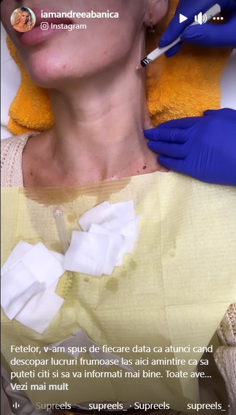 Ce interventie si-a facut Andreea Banică la fata 7