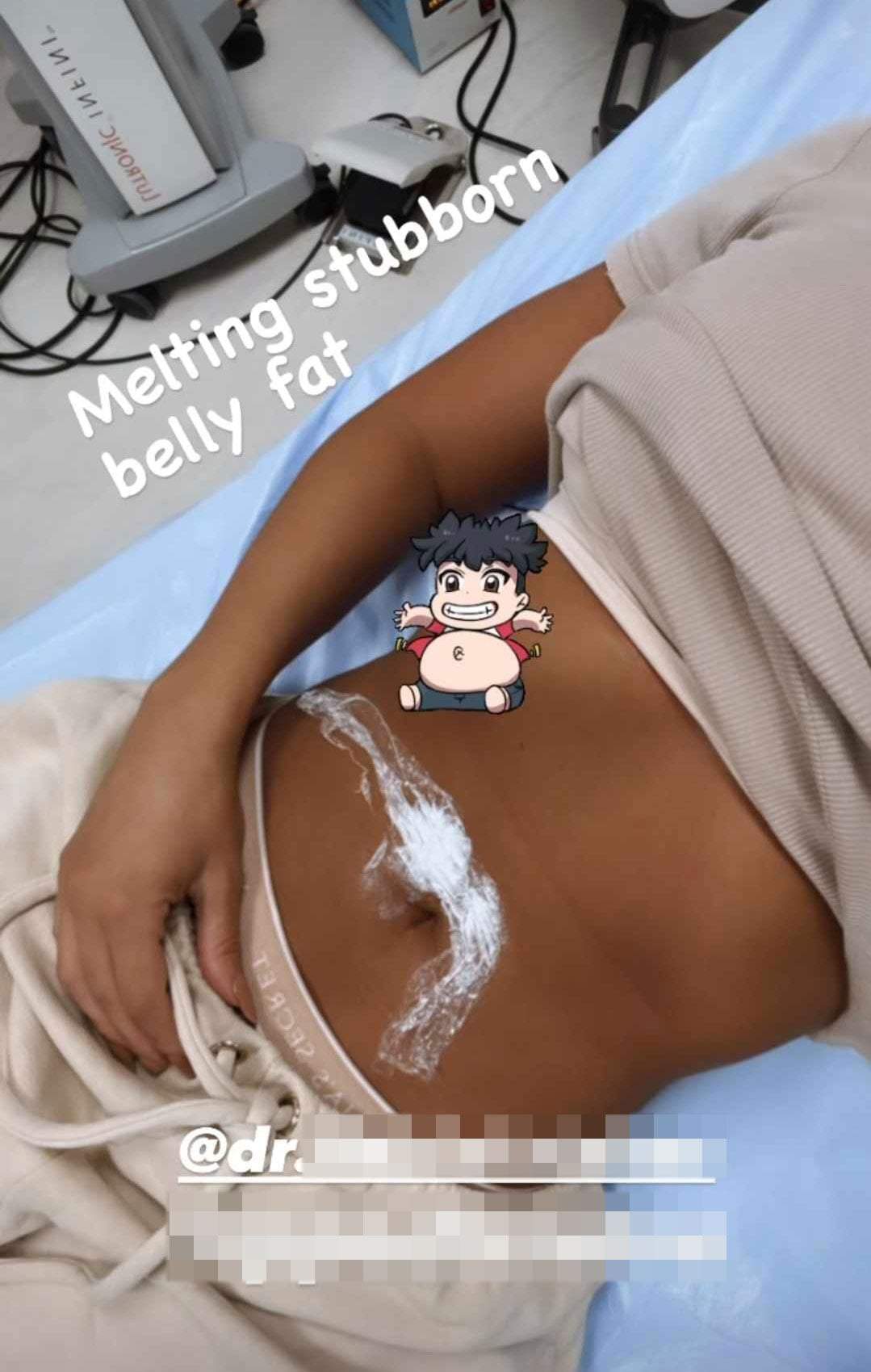 Claudia Iosif, Babs, si-a facut o noua interventie estetica 4