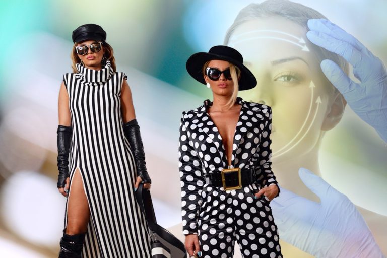 Claudia Iosif, Babs, o nouă intervenție estetică. Ce a ales să-și facă după despărțirea de Dorian Popa. Transformare spectaculoasă