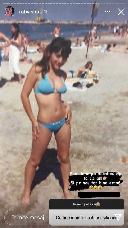 Cum arata Ruby, inainte sa-si faca operatii estetice 2