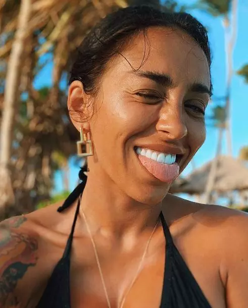 Cum arata Ruby, inainte sa-si faca operatii estetice 7