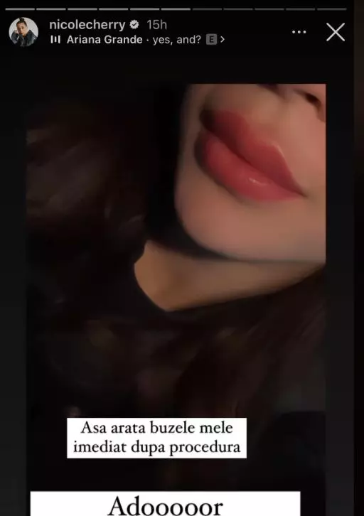 Nicole Cherry si-a facut o noua interventie, la nivelul fetei 3