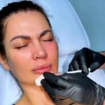 Nicoleta Luciu, o noua vizita la medicul estetician 3