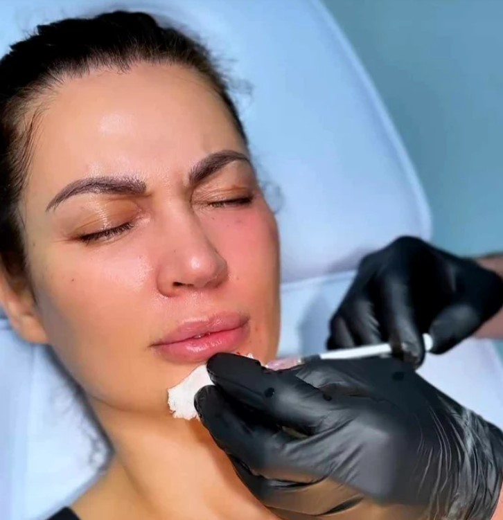 Nicoleta Luciu, o noua vizita la medicul estetician 3